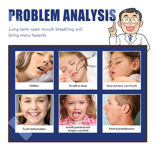 South Moon Anti-Snoring Tape Mouth Breathing Anti-Snoring Anti-Snoring Physical Expansion Nasal Tape Anti-Snoring Tape