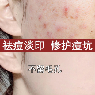 ˮ��������AҺˬ�wˮȥ�]�ڷ۴̝��ˮ�տsë��ȥ���^����ԭҺ