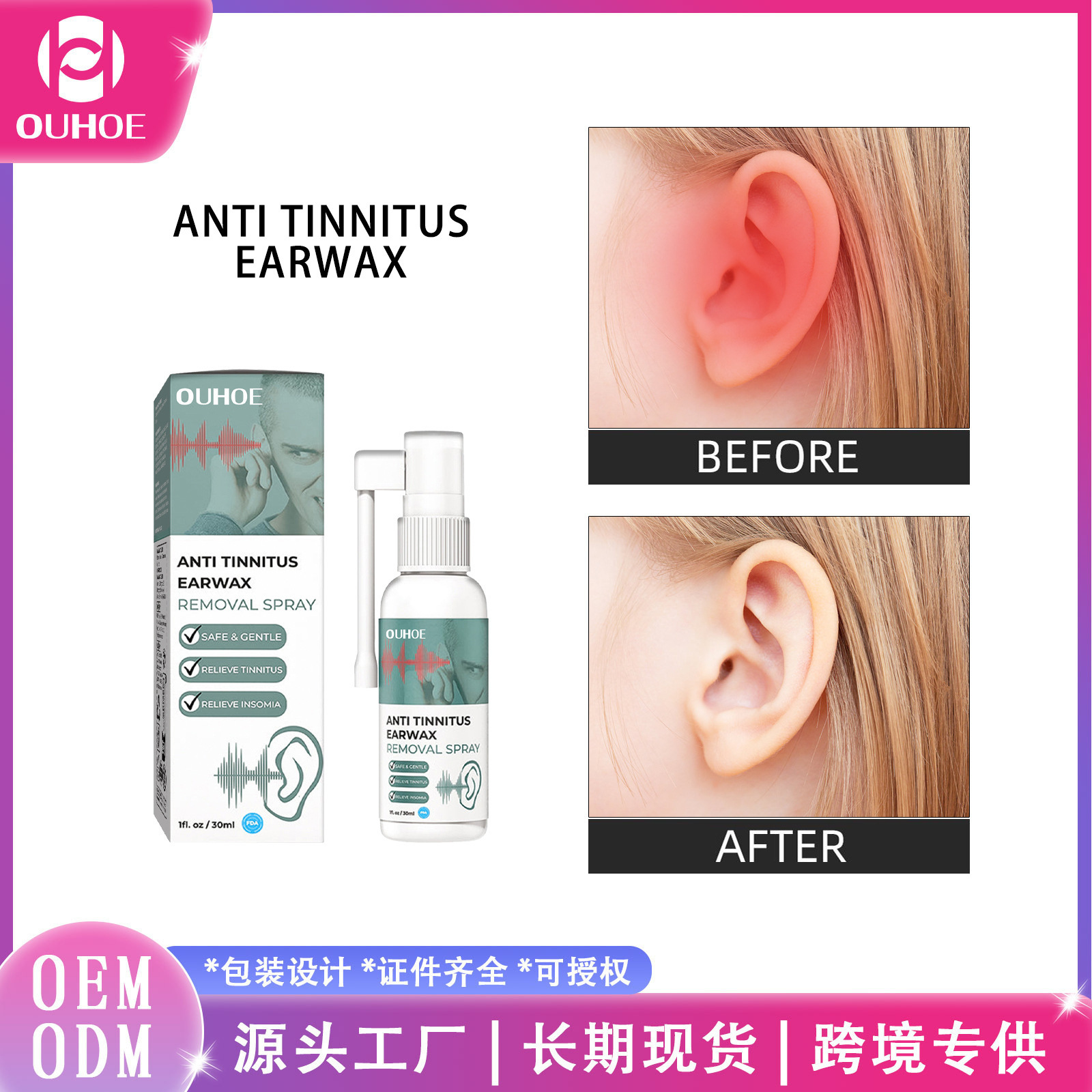 OUHOE Tinnitus spray relief ears