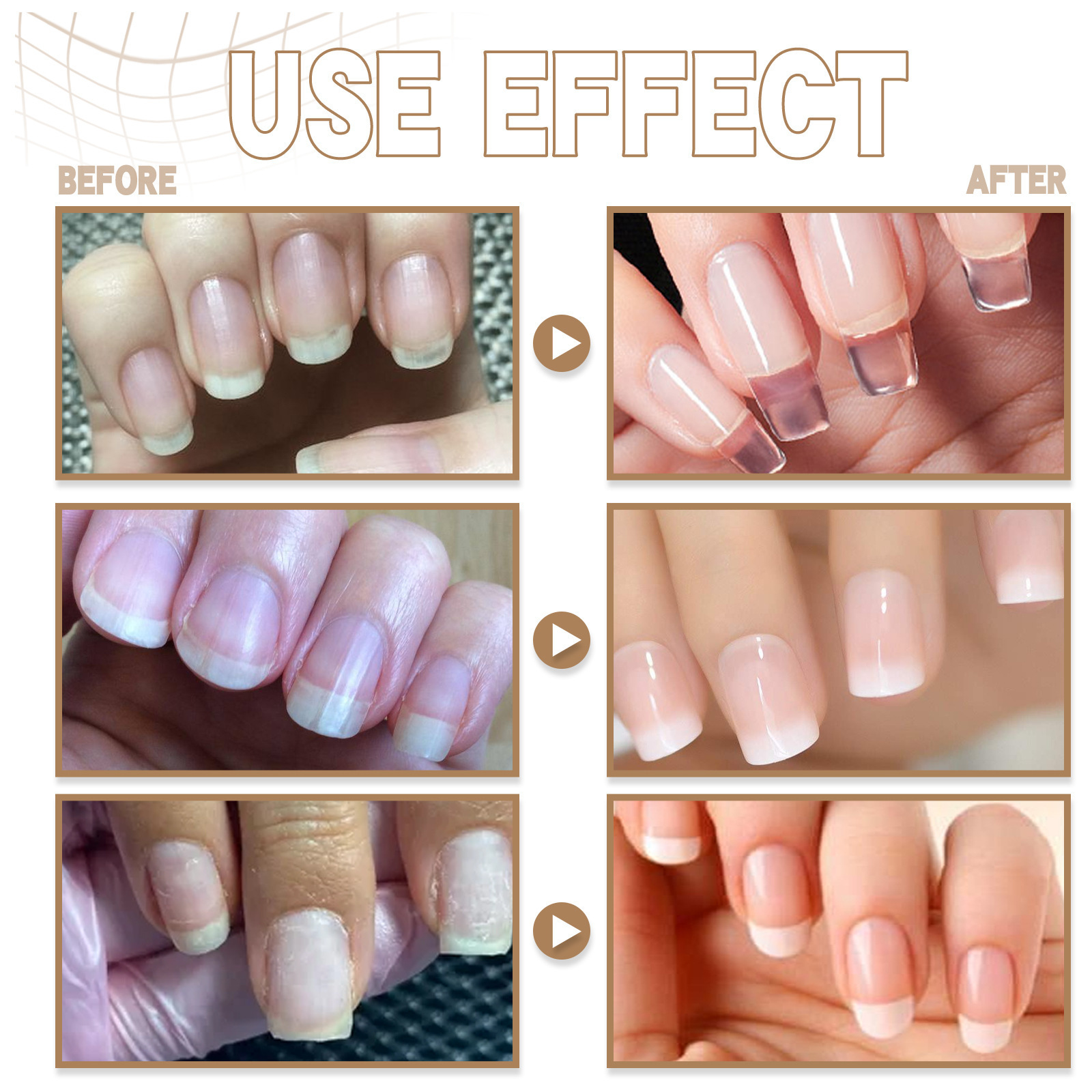 EELHOE Nail Extension Fiber Gel Nail Repair Light Therapy Crystal Glue Transparent Extension Lasting Armor Oil