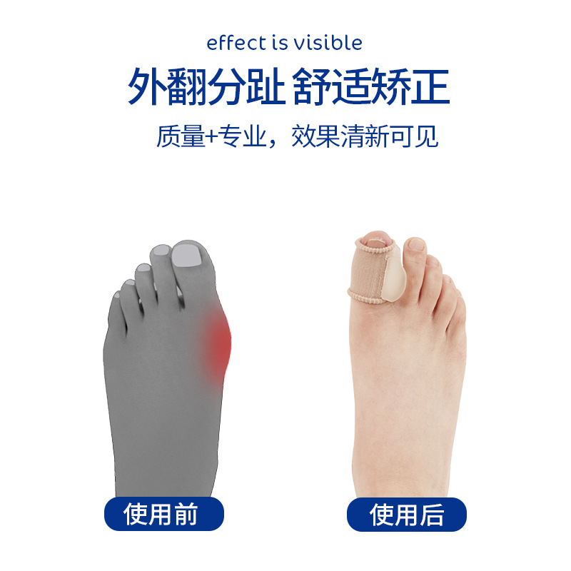 Big Foot pulgar cubierta lateral toe cubierta del dedo del pie Ballet protección delgada suave dedo grande curva dedo del pie separador anti-desgaste