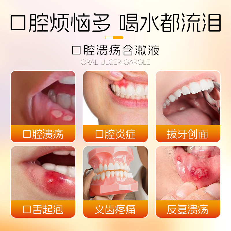 利君二类口腔含漱液缓解疼痛牙龈出血口腔溃疡口气清新剂清新医用