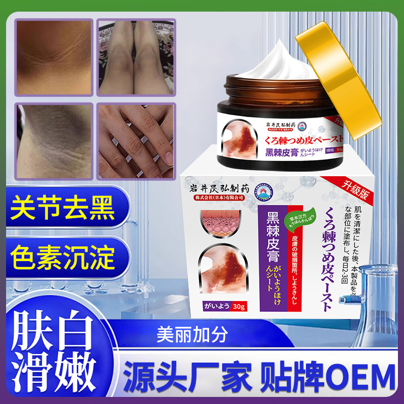 岩井昃弘去黑脖子黑色素沉淀症黑棘皮药膏脖颈关节黑肥胖洗不干净|undefined