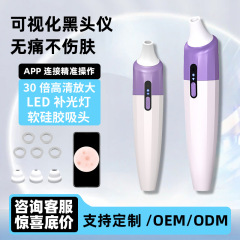 热销跨境可视化黑头仪大吸力电动吸鼻头去粉刺毛孔黑头神器清洁仪
