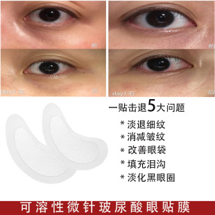Soluble Hyaluronic Acid Microneedle Eye Mask Desalination Fine lines Eye Bags Stay up Late Care Microneedle Eye Mask Hyaluronic Acid Eye Patch