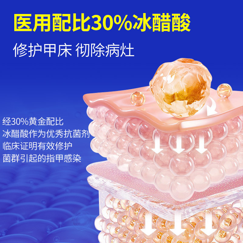 青原山30% 氷酢酸溶液塗布剤灰爪増厚ソフト甲溝外用抗菌液200ml|undefined