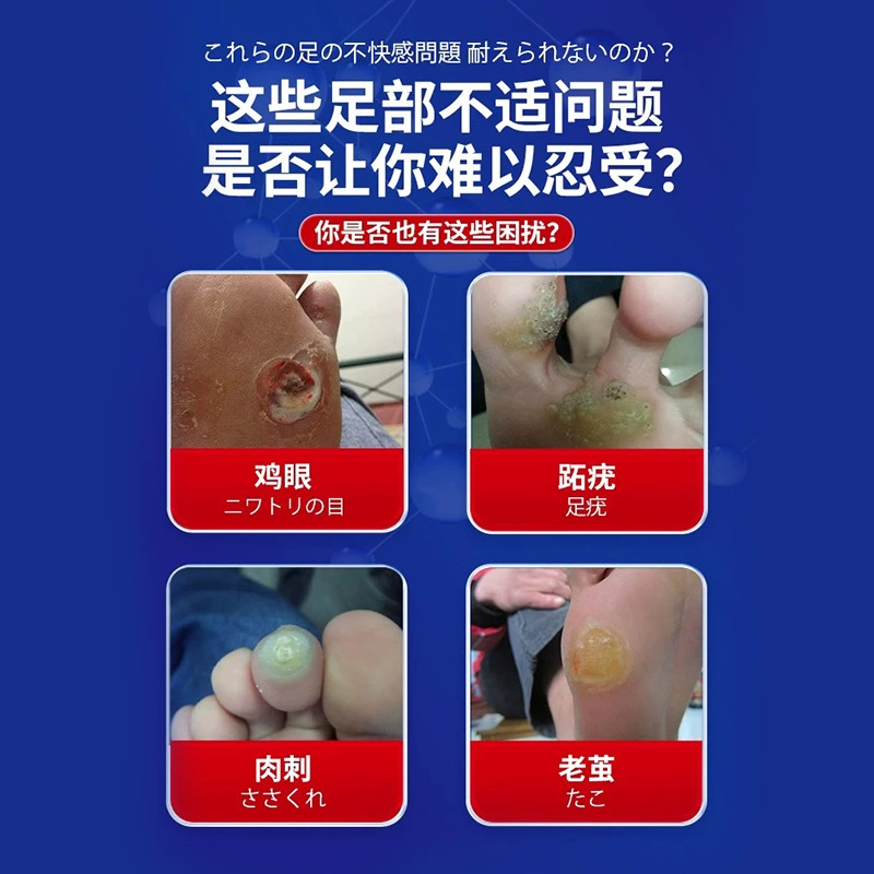 Iwari 瘊 瘊 瘊 瘊 Copycular Copycular Stabbing Factory