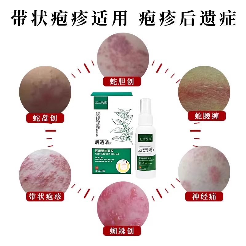 【公式正規品】Zhilan Yuekang Houkai クリア医療用解熱ジェルは、1 つの発送をサポートし、迅速に発送できます。|undefined