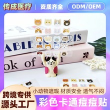 �羳���ƿ�ͨ�����N ��ɫ���ˮ�z�w�ڶ��N �ɐ�؈���ype�����N