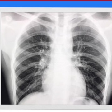 SDI输入 SDI输出 肠镜  胃镜显示器 医院肠胃镜科显示器