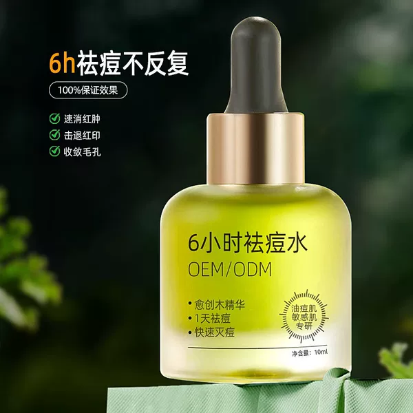 Herbal Anti-Acne Serum, Acne and Pimple Control Oil Control Essence Water, Hormone Acne Spot Treatment Water, Cosmetics