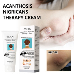 EELHOE Dark Spot Repair Cream, Nourishing Brightening Repair Underarm Arm Knee Joint Black Body Care Cream