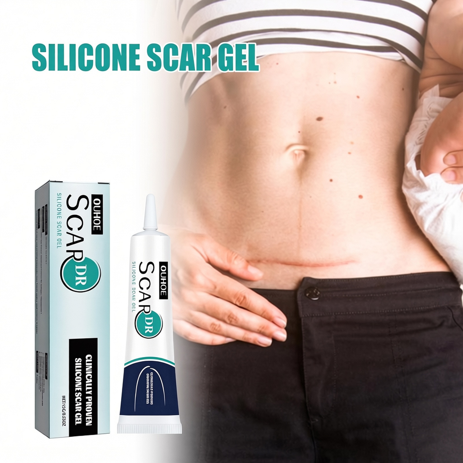 Ouhoe Scar Care Gel - Care for Scars, Surgical Marks, Smooth Skin, Body Care Gel
