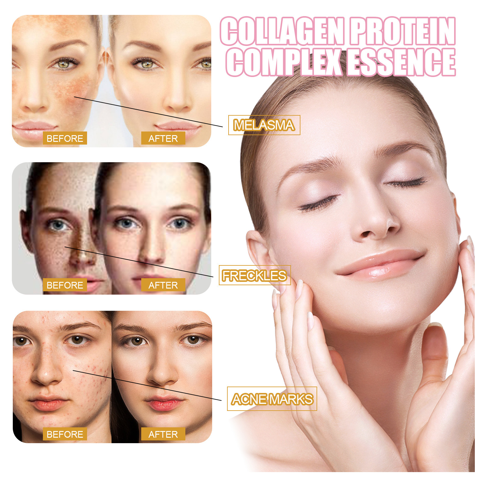 La Solution d'essence de collagène d'essence d'embryon de mouton EELHOE soulève, resserre, améliore le tonus, éclaircit les taches, hydrate et_voghion.com