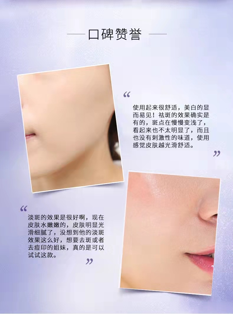 祛斑霜套盒
