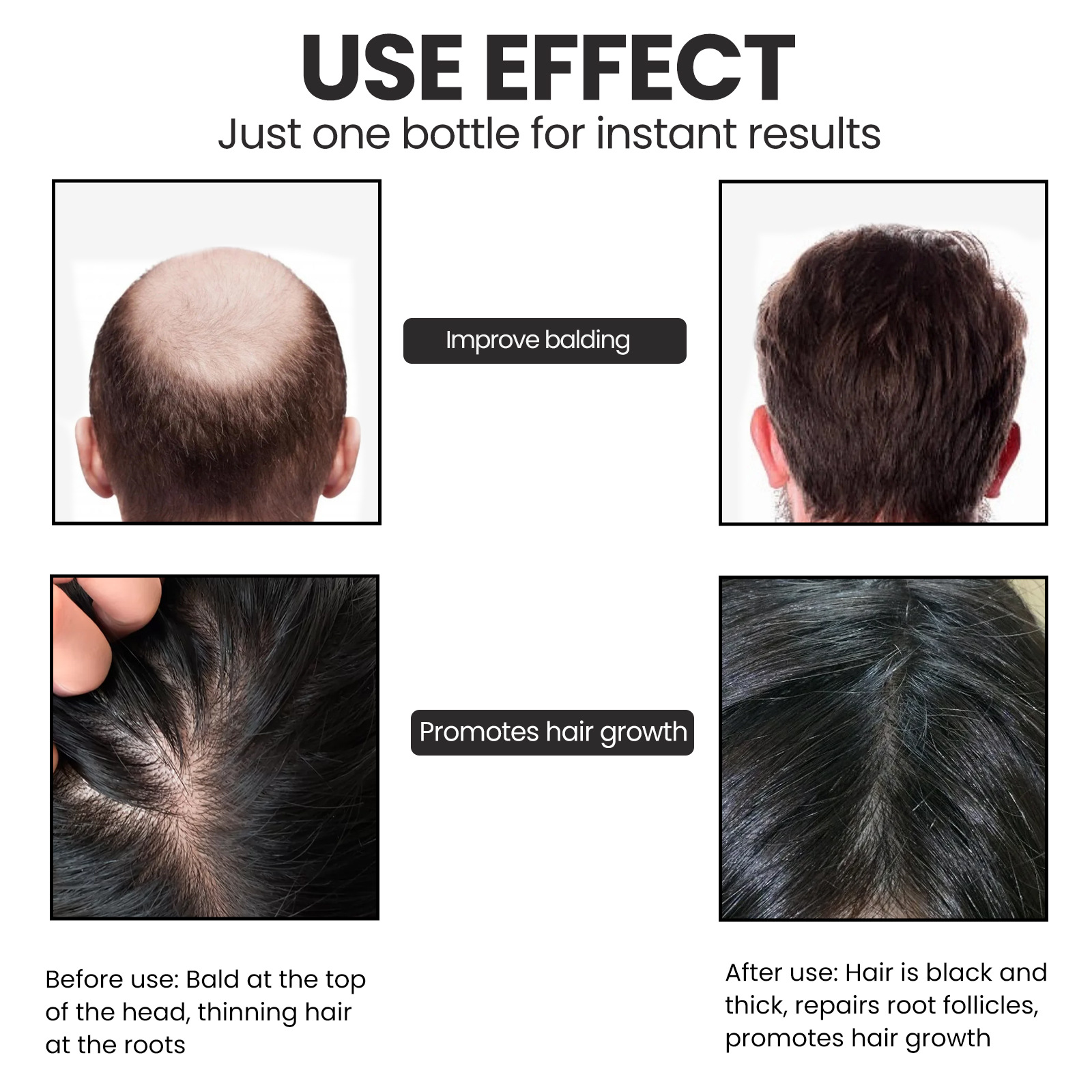 OUHOE Biotin Moisturizing Root Dense Repairing Hairline Strong and Firm Hair Essence_voghion.com