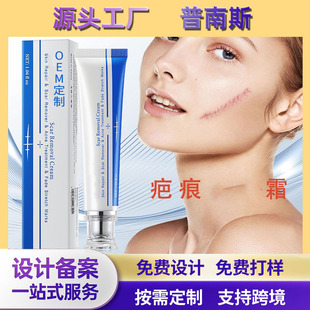 Cross-Border Popular Foreign Trade Scar Cream, Scar Cream to Fade Acne Marks, Post-Caesarean Section Scar Cream, Burn Scar Cream
