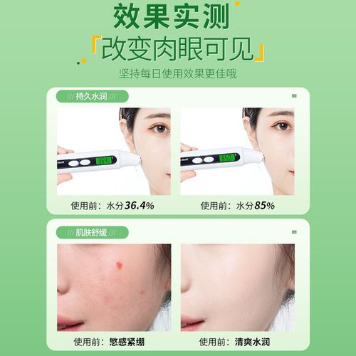 Bodybuilding Chuangyan Aloe Vera Gel Soothing, Moisturizing and Repairing 300g Large Capacity Fading Acne Marks Female Gel Cream Wholesale