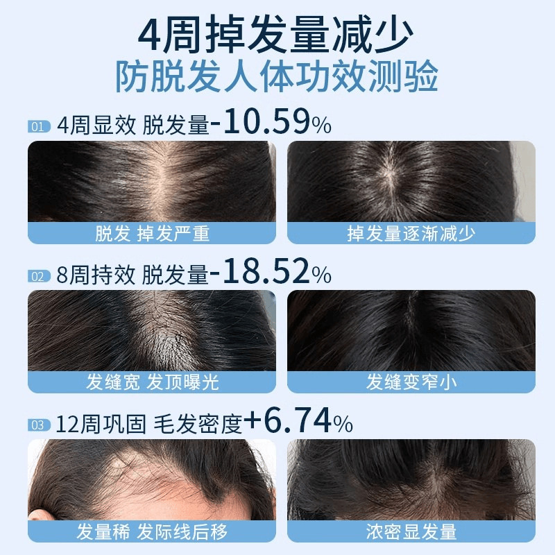 抜け毛防止シャンプー、育毛、毛根強化、抜け毛防止、切れ毛防止、ふわふわ、さわやか、オイルコントロール、ふけ防止、ヒノキ葉シャンプー|undefined