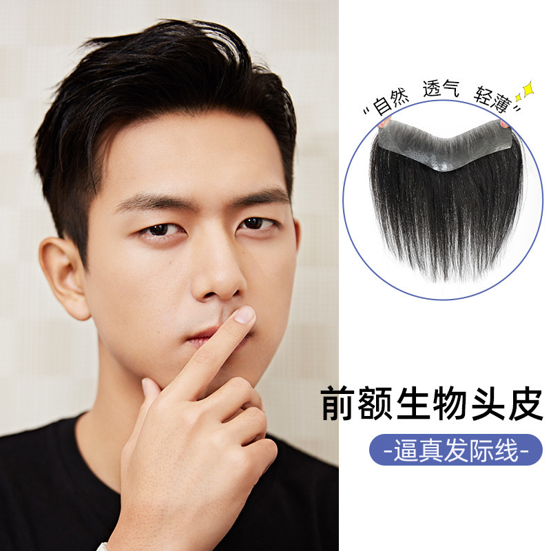 发际线假发贴男士前额无痕补发片真发隐形生物头皮M型额头刘海片|undefined