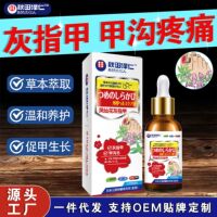 灰指甲抑菌液凤仙花脚臭灰指甲专用液脱甲膏甲液灰指甲药膏灰甲王