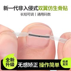 甲沟嵌甲双翼镍钛合金仿生骨贴正甲贴片脚趾甲指甲扎肉炎矫正器
