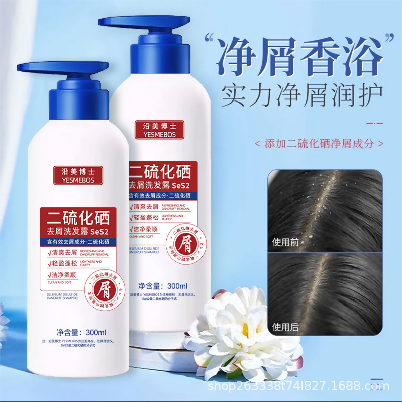 Disulfuro de selenio anti-caspa champú controlador de aceite suave anti-picazón refrescante controlador de aceite suave mejora la piel seca y la capa profunda de limpieza