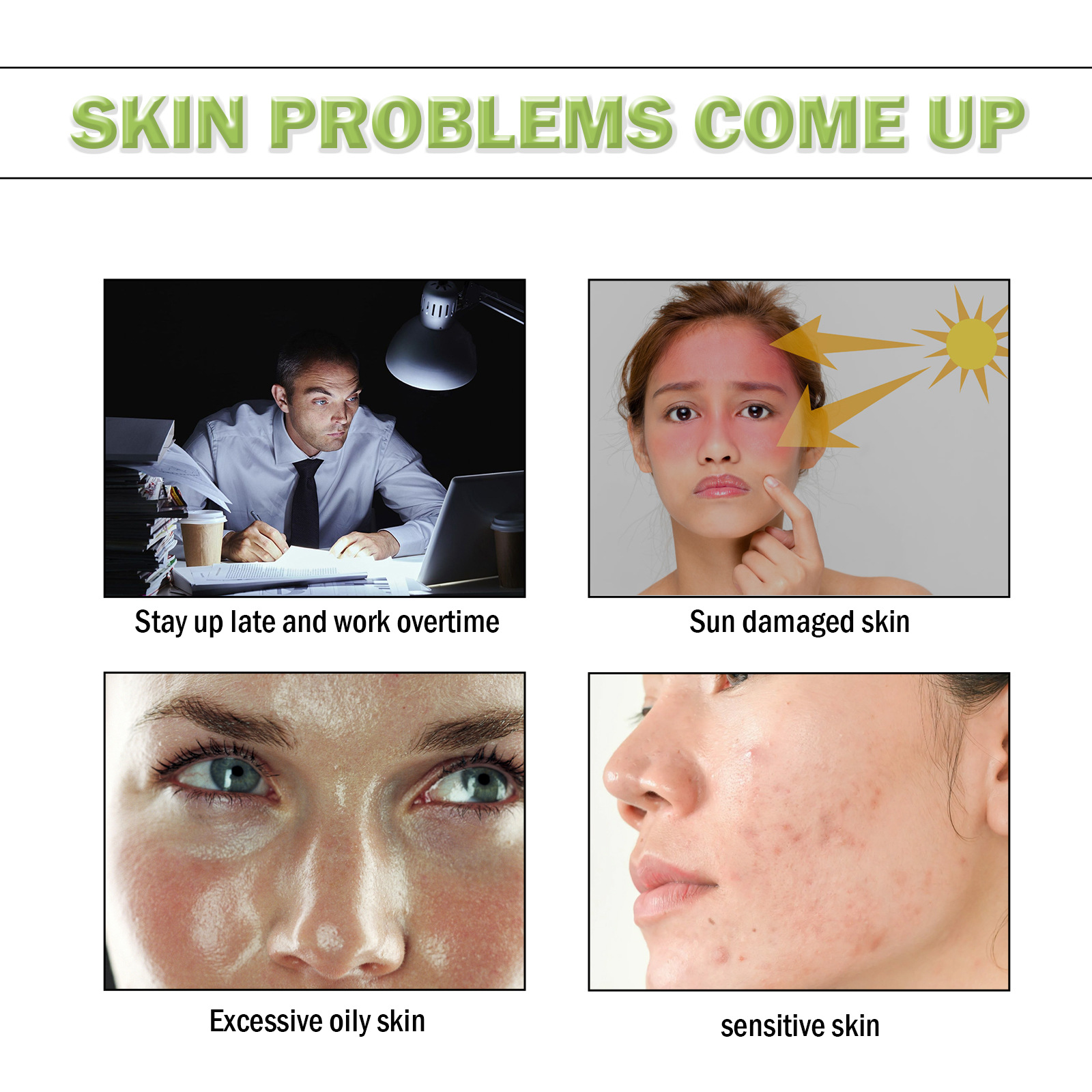 EELHOE Tea Tree Repair Lightens Marks, Cleans Acne, Removes Acne and Repairs Skin essence_voghion.com