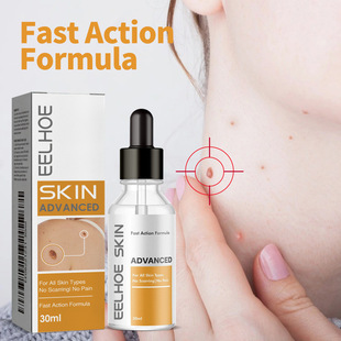 EELHOE Keyou Essence Deep Cleansing Smooth Skin Fade Hand and Foot Eyesus Keyou Essence