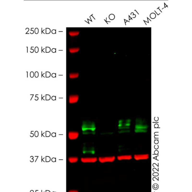 Abcam ab235578 Anti-TGF beta Receptor I 抗体10µl