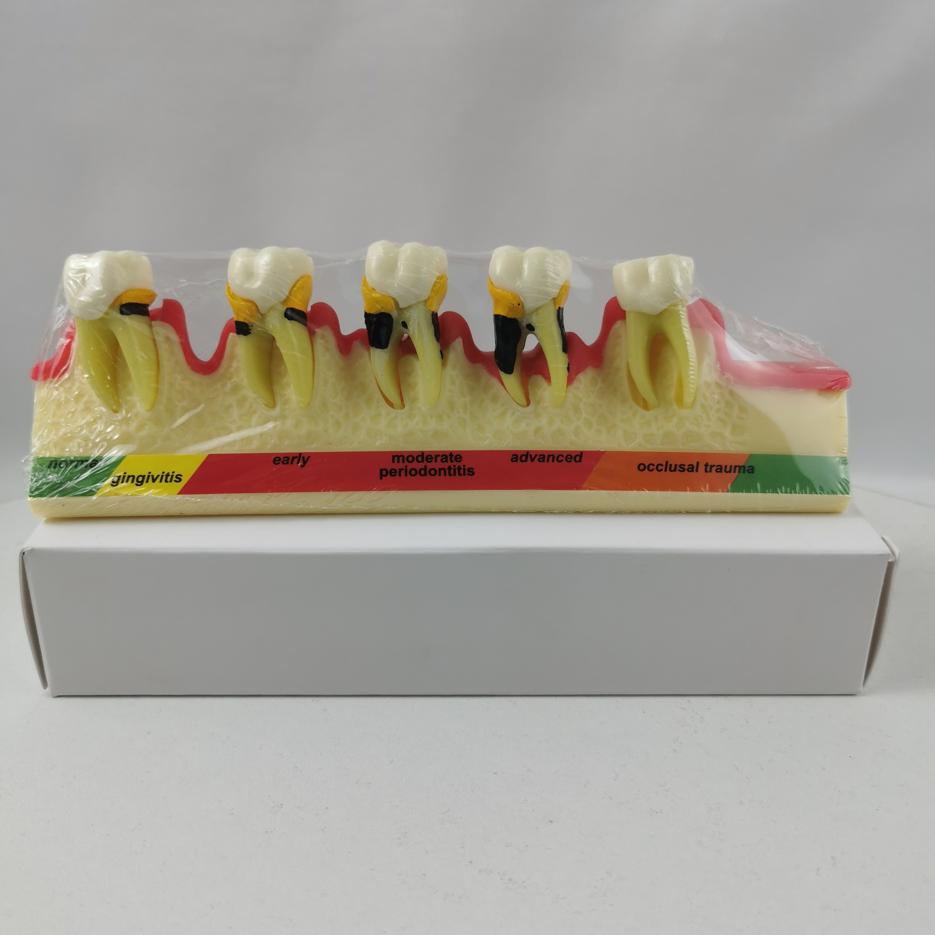 M4010牙周  分类牙齿模型