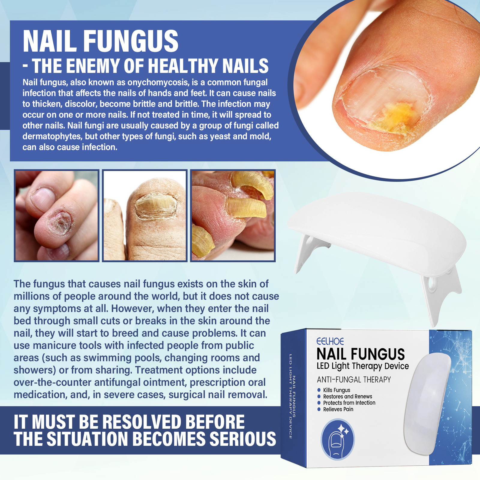 EELHOE repair LED phototherapy instrument for hand foot nails yellowing, soft repair, thickening, and smoothing of the_voghion.com