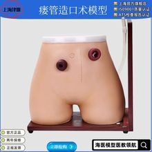 造口模型 高级瘘管造口术护理模型 结肠回肠造瘘教学模型 造口冲
