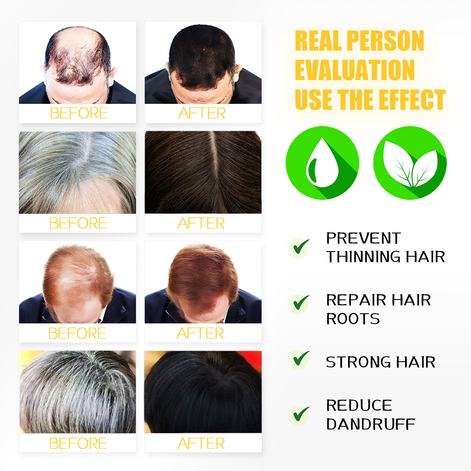 Confezione di shampoo per capelli neri South Moon L'essenza di zenzero idrata i capelli Cura detergente naturale per capelli neri_voghion.com