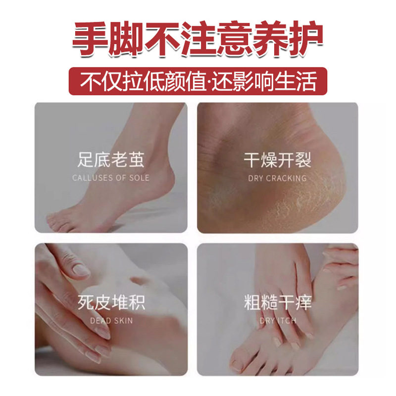 홍콩 말 오일 크래킹 크림 손 발 필링 수리 거친 피부 건조 크래킹 보습 핸드 크림
