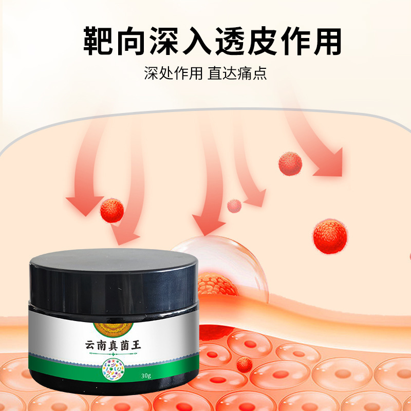 云南真菌王手足脱皮膏手足㿍外用保健乳膏足部瘙痒膏厂家直销代发|undefined