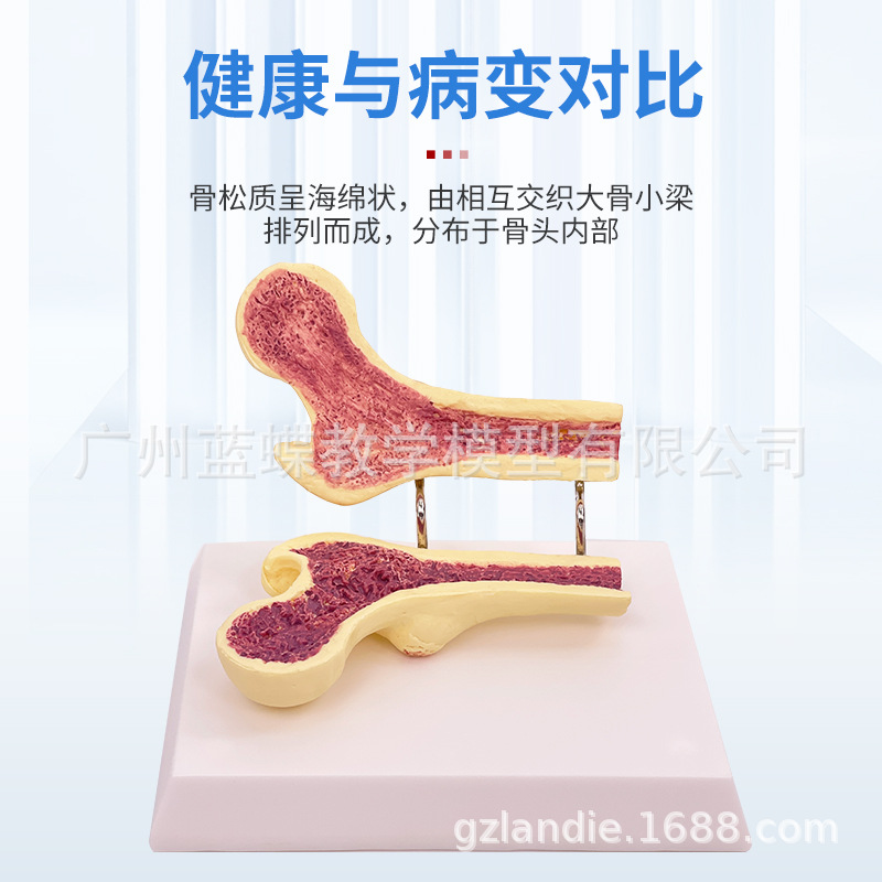 ����ɹǹ������ɽ���ģ���ȹǽ����� ��������걾 ������׵ģ��