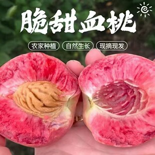 �����Ϙ�Ѫ�����r����ë�Ҵ����x�����ЋDˮ���iѪ�t����һ�����l
