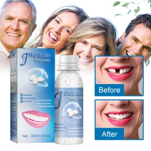 Moldable Denture Dental Glue for Film and Television Makeup Modification, Temporary Tooth Filling Glue, Fake Tooth Filling Holes, Broken Teeth, and Tooth Gap Filling