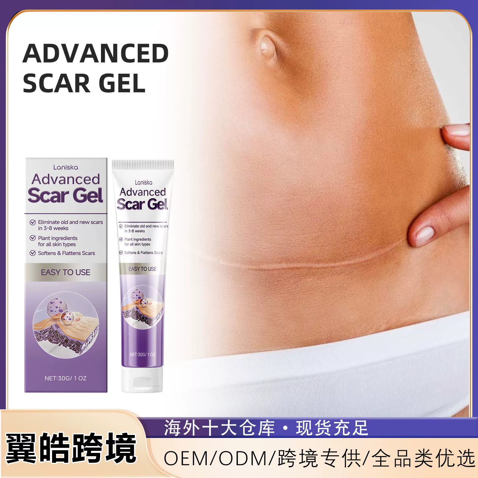 Гель для ухода за кожей Laniska мягко устраняет и восстанавливает пятна на коже, делая ее гладкой, нежной и эластичной.