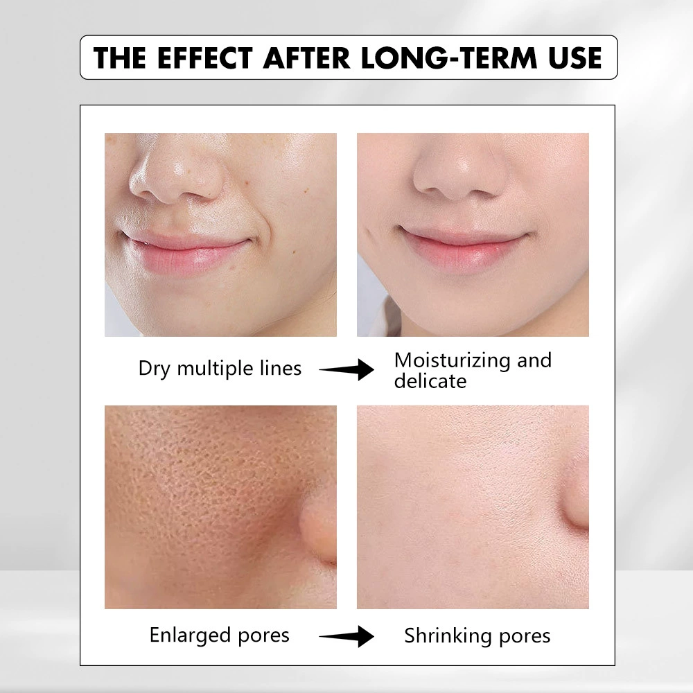 Face care set (KOEC) Vitamin C serum + Snail Mucin 92% moisturizing cream, repairing & hydrating