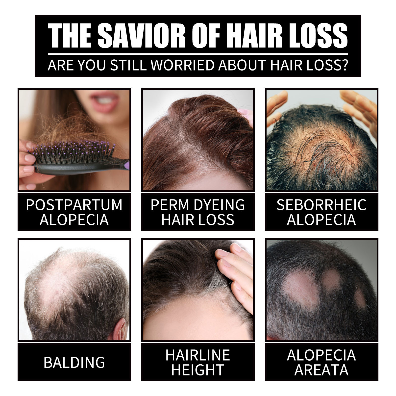 OUHOE Collagène B7 Vitamine Croissance Huile Essentielle Dense, Raffermissante, Anti-Casse et Soin Capillaire_voghion.com