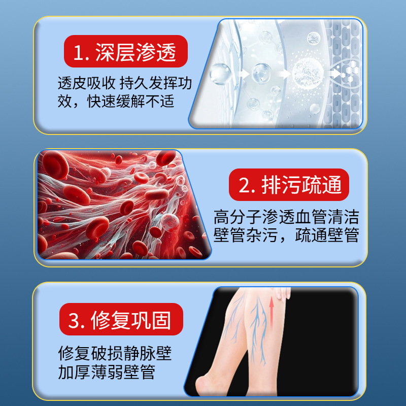 静脉舒膏冷敷凝胶精索曲张药膏 筋脉青筋凸起蚯蚓工厂直营静脉膏|undefined
