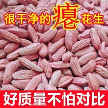 ���xɽ�|�T�����׸ɰTС���������r�T������С���������Bθ�T����