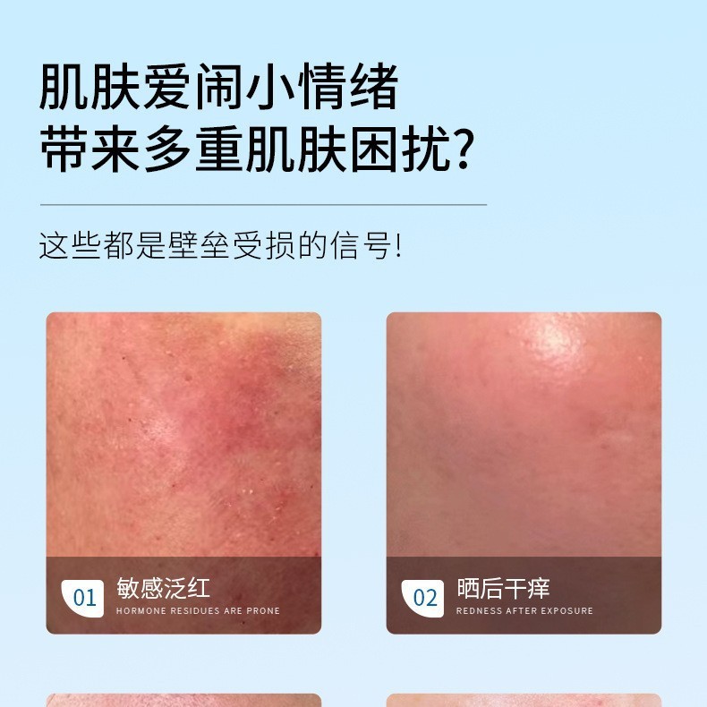 美容院专供护肤品修复屏障退红增厚角质维稳呵护液面部护理套装|undefined