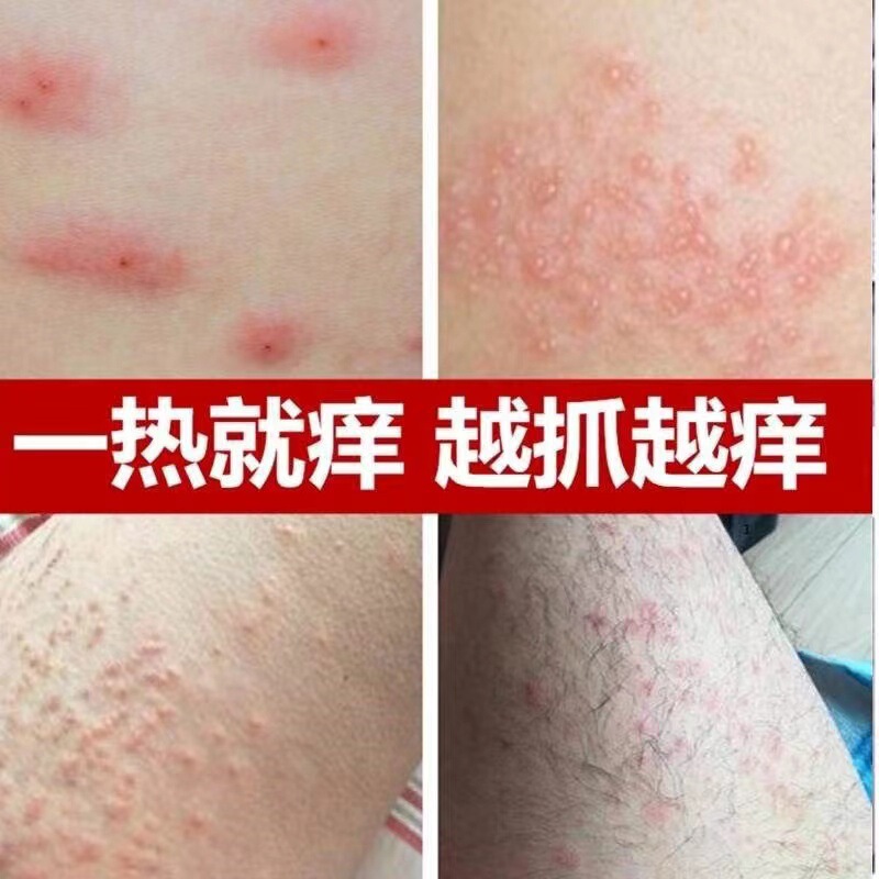 かゆみ止め王 銀含有 皮膚炎ケア かゆみ止めケア 卸売発送 体の痒み対策|undefined