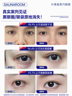 ♔ 2025 New Lutein Steam Eye Mask Relieves Eye Fatigue, Fever, Sleep, Shading, Student Hot Compress, Eye Protection Plus