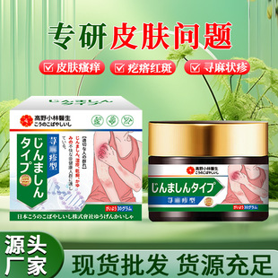 Nettle Allergy Anti-Itch Cream Skin Itching Acute and Chronic Ointment Improves Immunity Skin Erythema External Health Care Cream
