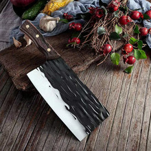 ���i���Ȫ���ֹ�呴���е���Ƭ���u��ľ�ֱ��h���˵������عǵ�