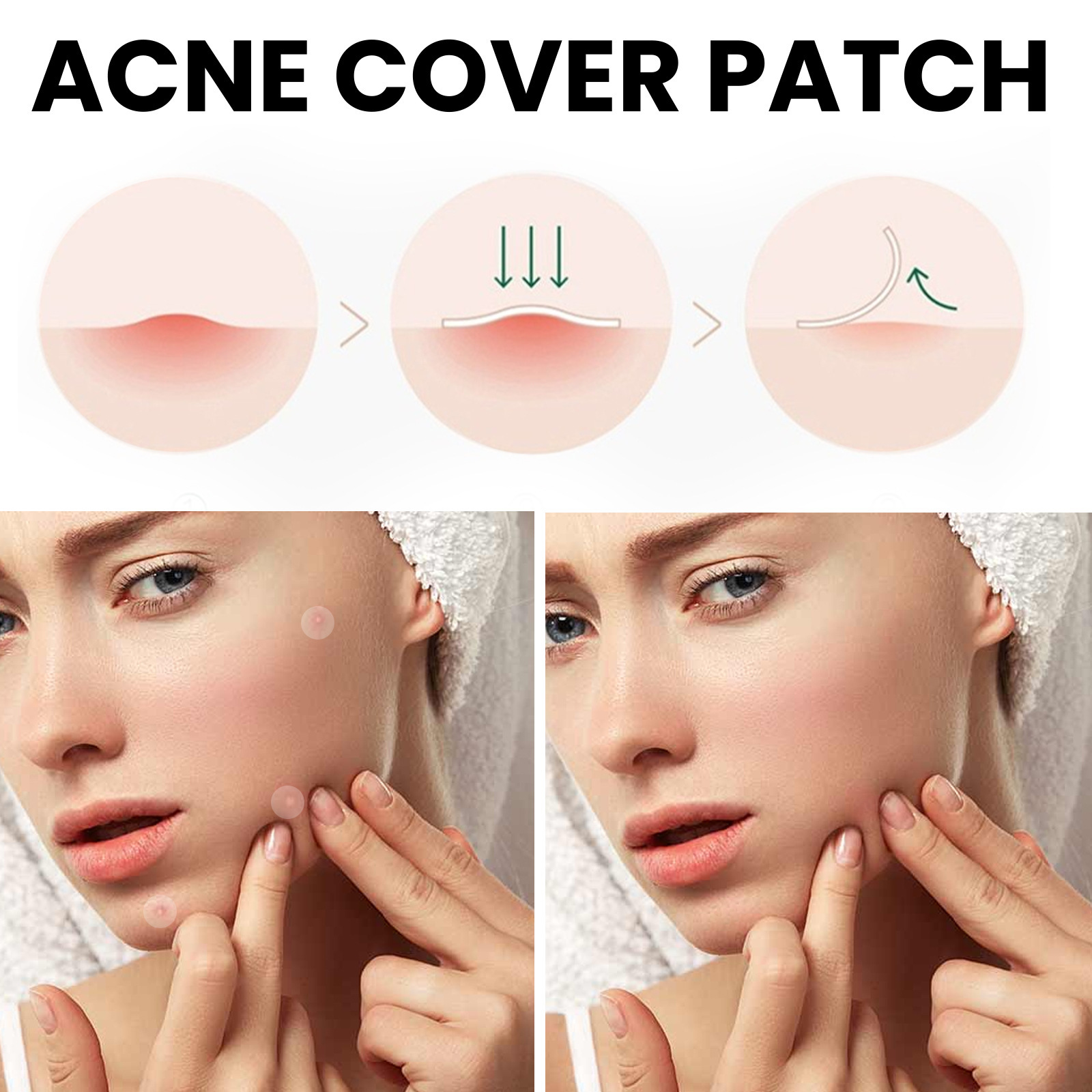 West&Month Repair for Acne, Closed Mouth Smooth Skin, Breathable Acne Patch_voghion.com